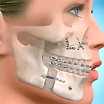 Cirurgia e Traumatologia Buco Maxilo Facial