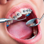 Ortodontia com Ênfase em Cirurgia Ortognática